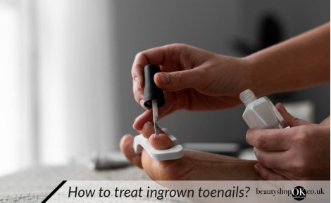 How to treat ingrown toenails?