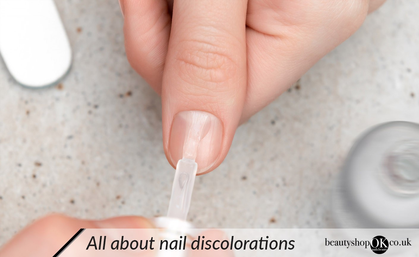 Are nail discolorations symptoms of nail disease?
